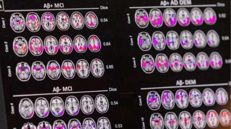  【技术深度】pTau217血液标志物：阿尔茨海默病早筛的精准革命与现实困境 新闻 【技术深度】pTau217血液标志物：阿尔茨海默病早筛的精准革命与现实困境 新闻 【技术深度】pTau217血液标志物：阿尔茨海默病早筛的精准革命与现实困境 新闻