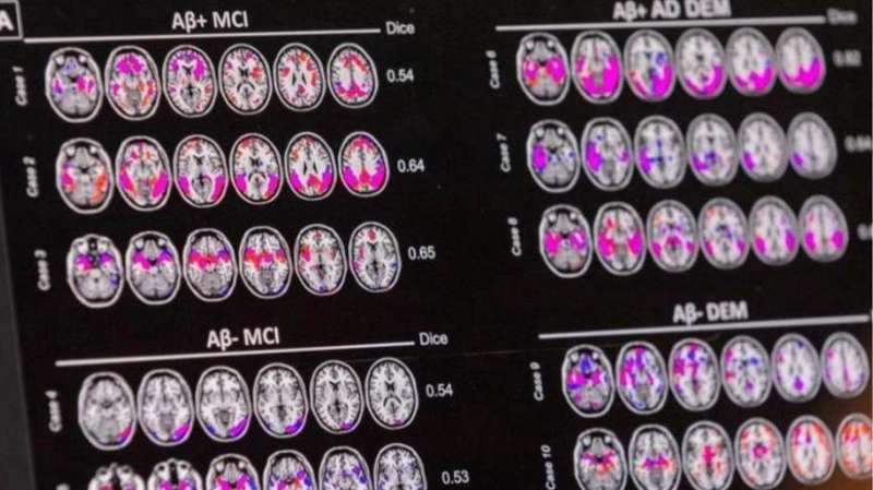  【技术深度】pTau217血液标志物：阿尔茨海默病早筛的精准革命与现实困境 新闻 【技术深度】pTau217血液标志物：阿尔茨海默病早筛的精准革命与现实困境 新闻 【技术深度】pTau217血液标志物：阿尔茨海默病早筛的精准革命与现实困境 新闻